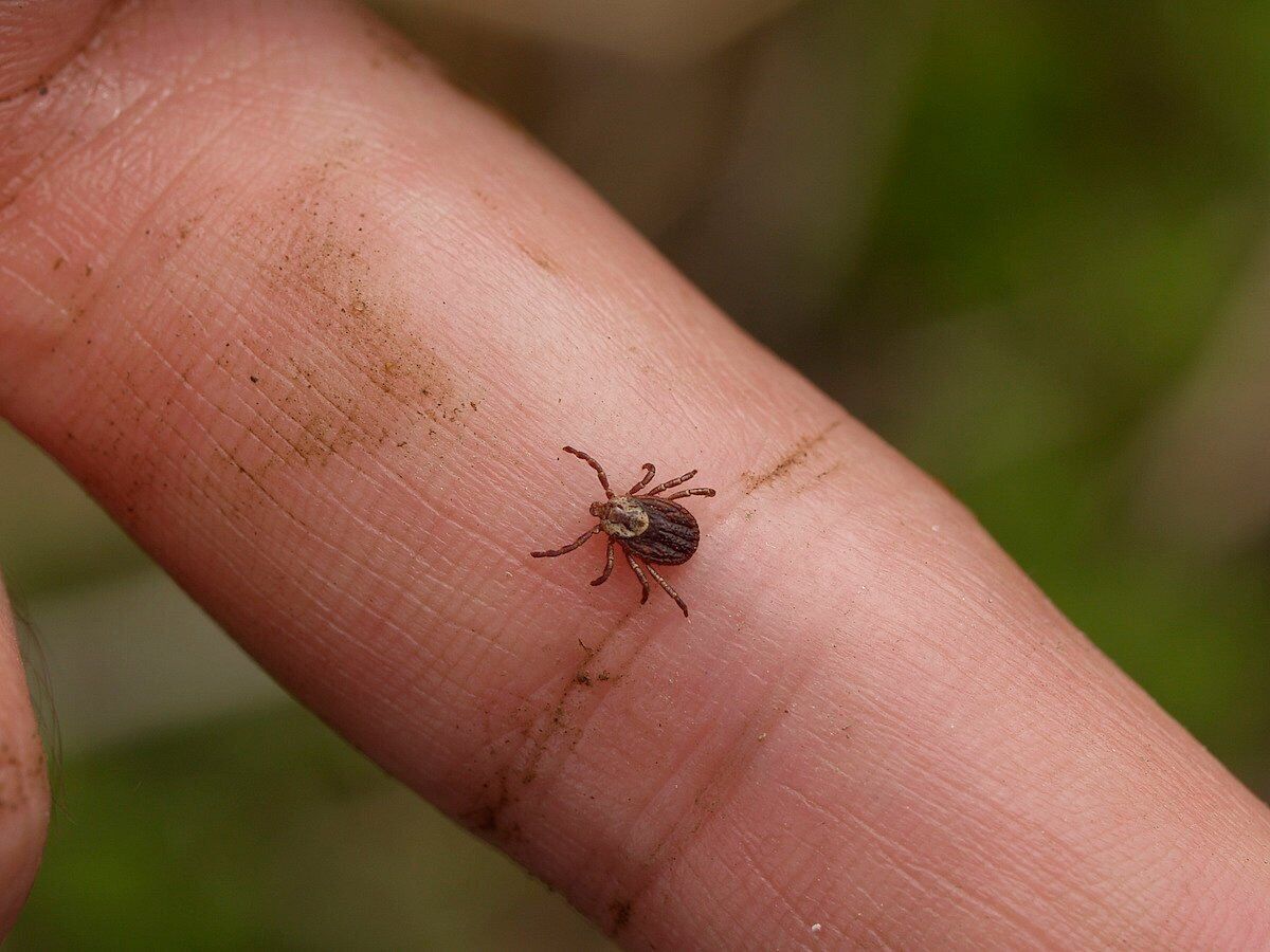 Lyme Disease: What To Know About Symptoms, Treatment & Prevention